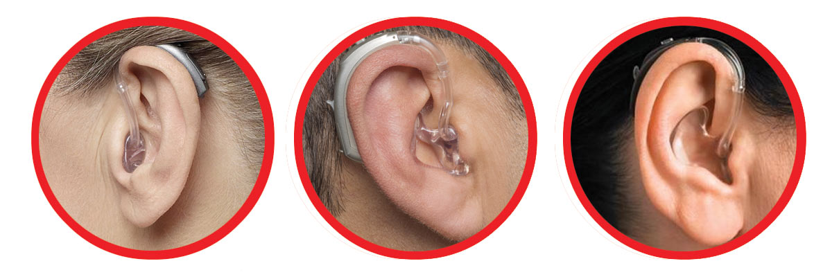 Kattints a képre, ha nagyobb méretben szeretnéd megtekinteni! Illesztékek