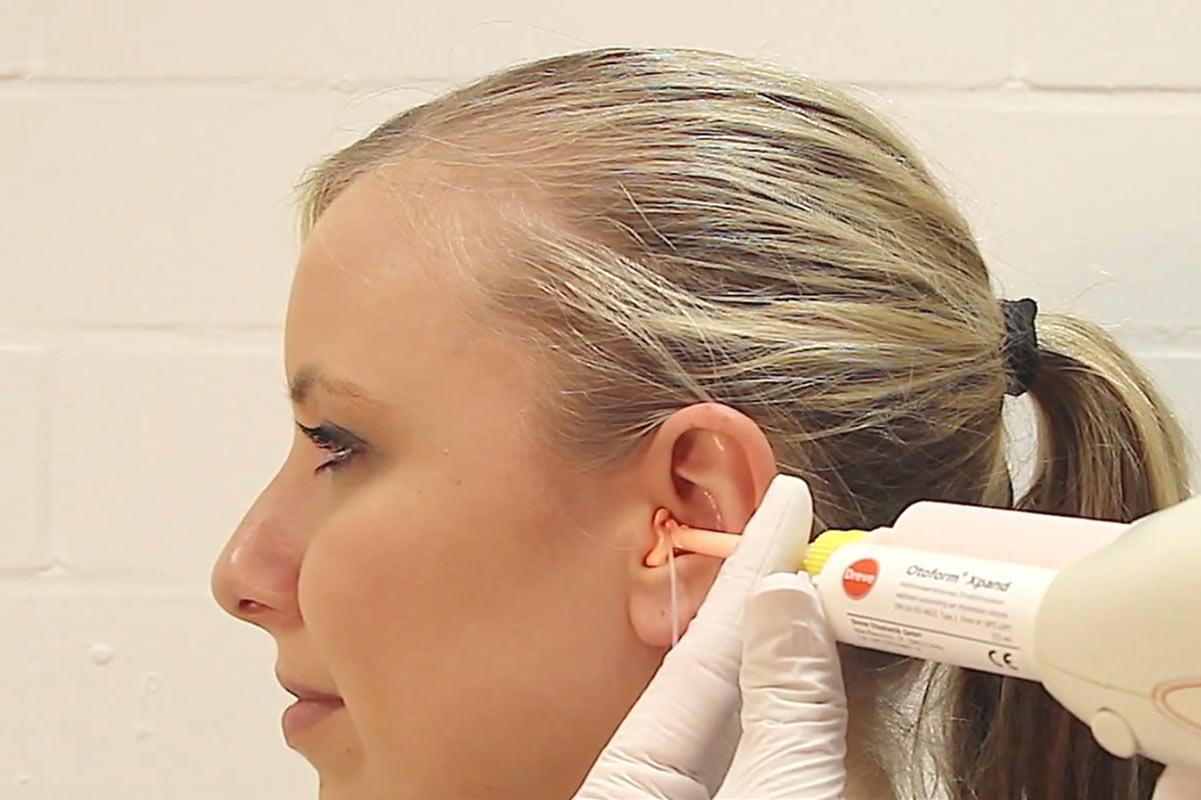 Kattints a képre, ha nagyobb méretben szeretnéd megtekinteni! Illesztékek